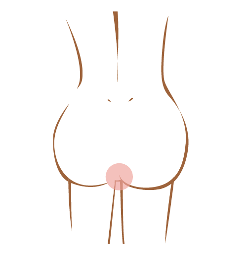 痔